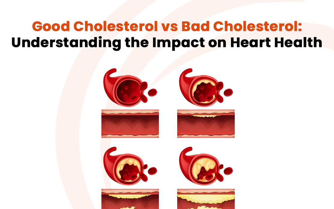 Natural Ways: Lowering Cholesterol